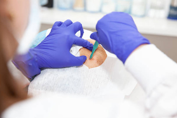 Understanding Biopsy Diagnostics for Precise Treatment