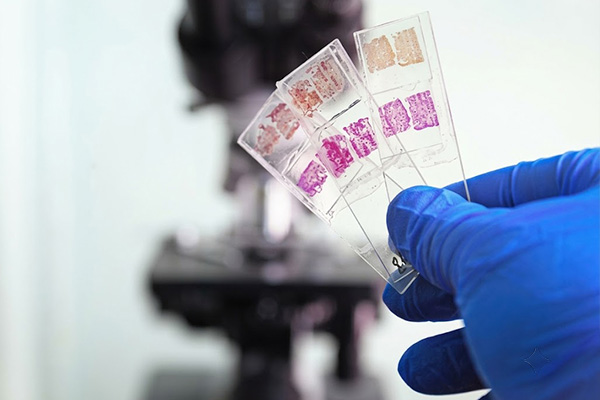 Decoding Tissue: Histopathology's Indian Revolution